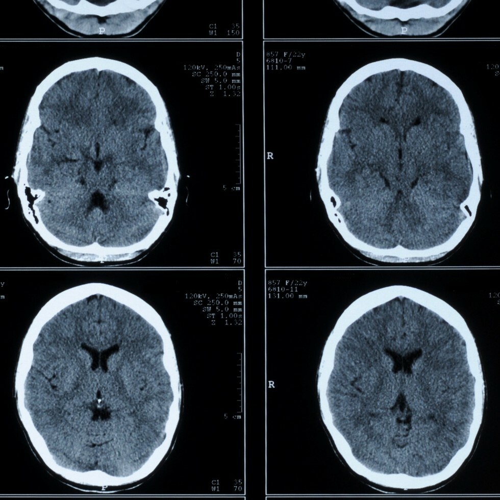 head scans